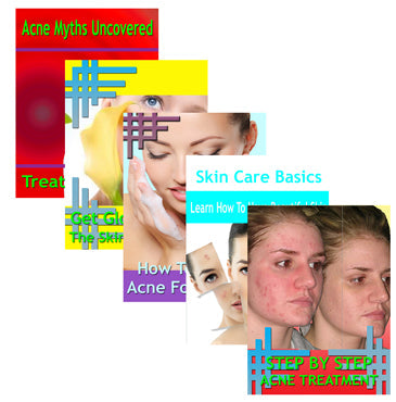 Beating Acne 5 Guides Collection eBook