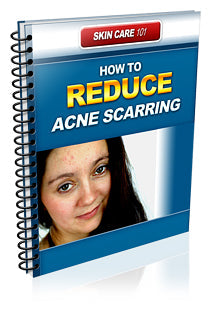 How To Reduce Acne Scarring eBook